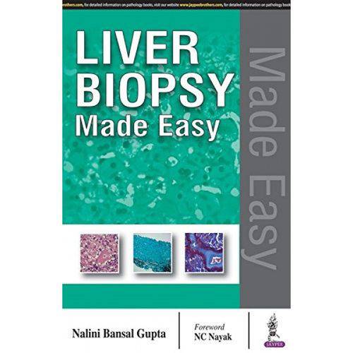 Liver Biopsy Made Easy (Inglês)