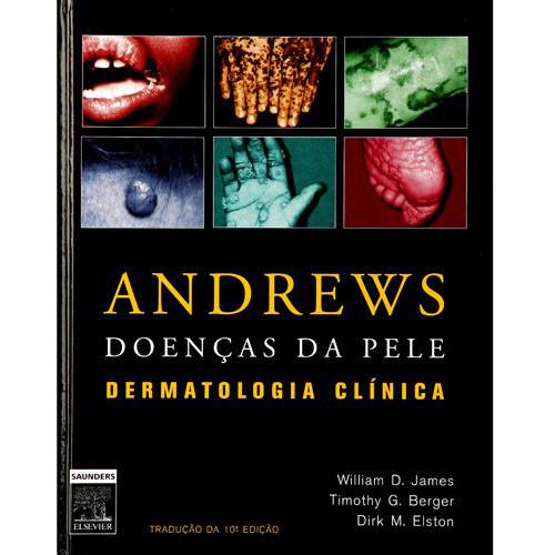 Livro - Andrews Doenças da Pele