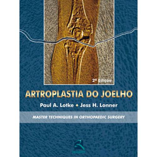 Livro - Artroplastia do Joelho: Master Techniques In Orthopaedic Surgery