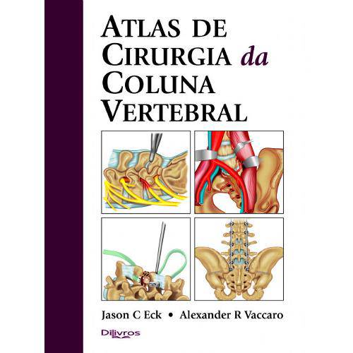 Livro - Atlas de Cirurgia da Coluna Vertebral - Eck