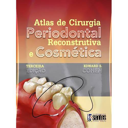 Livro - Atlas de Cirurgia Periodontal Reconstrutiva e Coméstica