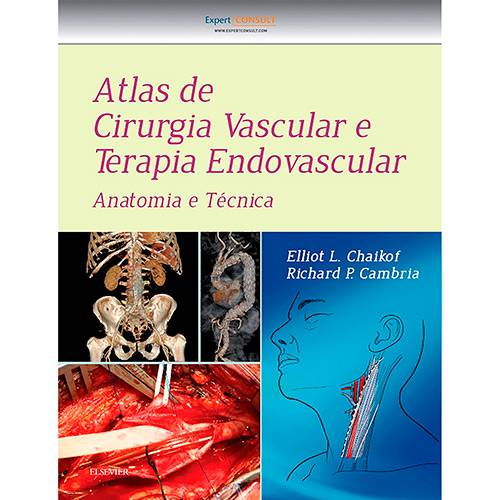 Livro - Atlas de Cirurgia Vascular e Terapia Endovascular: Anatomia e Técnica