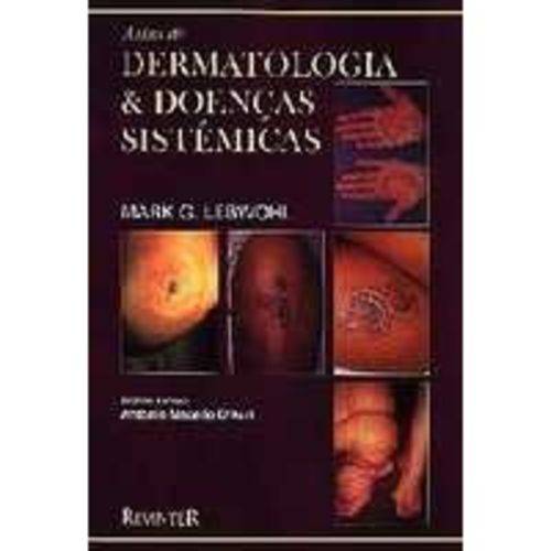 Livro - Atlas de Dermatologia e Doenças Sistêmicas - Lebwohl