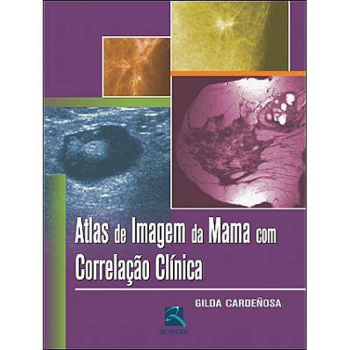 Livro - Atlas de Imagem da Mama com Correlação Clínica - Cardeñosa