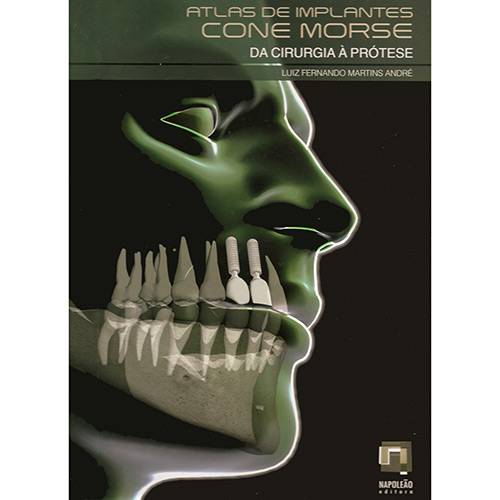 Livro - Atlas de Implantes Cone Morse - da Cirurgia à Prótese