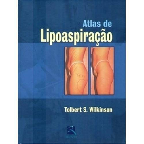 Livro - Atlas de Lipoaspiração - Wilkinson