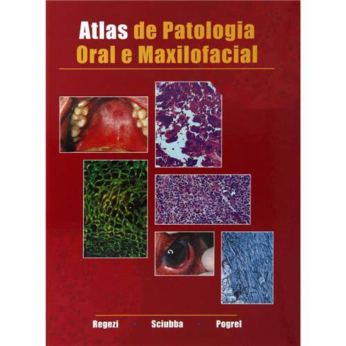 Livro - Atlas de Patologia Oral e Maxilofacial