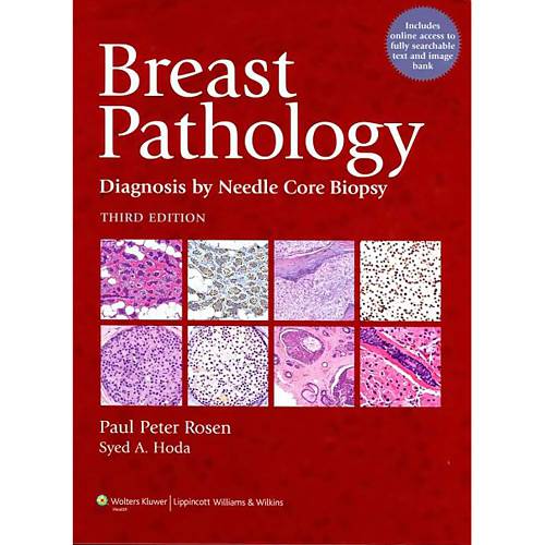 Livro - Breast Pathology - Diagnosis By Needle Core Biopsy