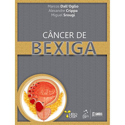 Livro - Câncer de Bexiga
