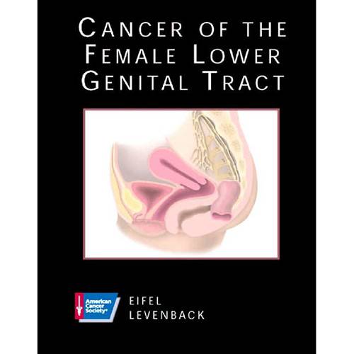 Livro - Cancer Of Female Lower Genital Tract