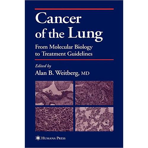Livro - Cancer Of The Lung - From Molecular Biology To Treatment Guidelines