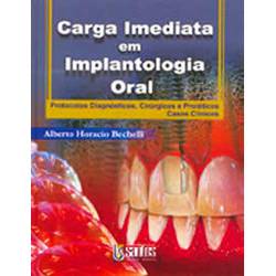 Livro - Carga Imediata em Implantologia Oral