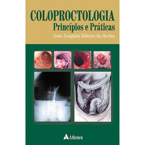 Livro - Coloproctologia - Princípios e Práticas