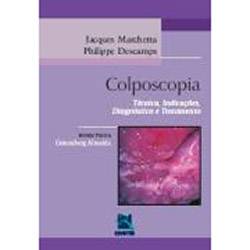 Livro - Colposcopia: Técnica, Indicações, Diagnóstico e Tratamento