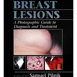 Livro - Common Breast Lesions - a Photographic Guide To Diagnosis And Treatment