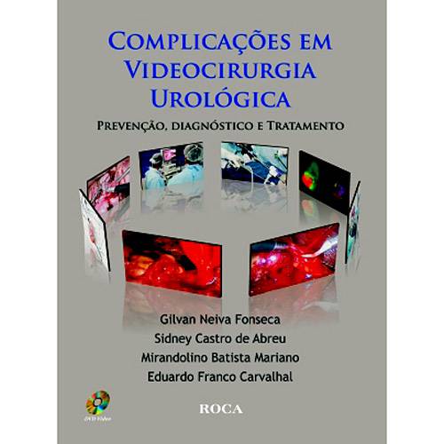 Livro - Complicações em Videocirurgia Urológica - Prevenção, Diagnóstico e Tratamento