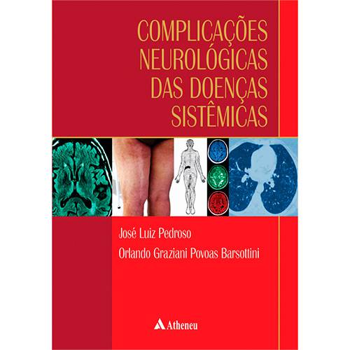 Livro - Complicações Neurológicas das Doenças Sistêmicas