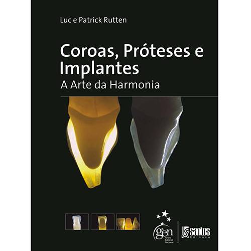 Livro - Coroas, Próteses e Implantes: a Arte da Harmonia