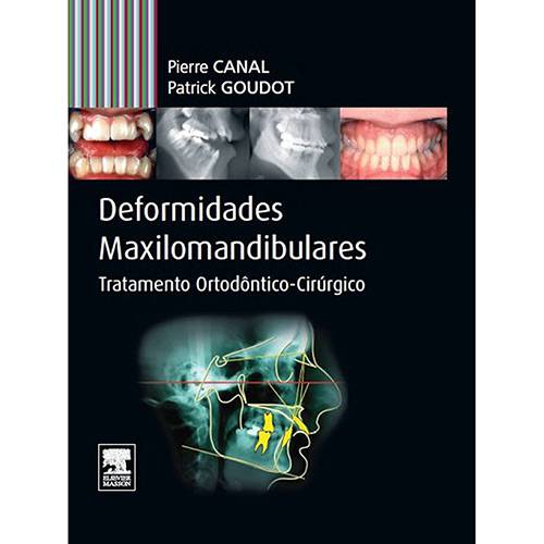 Livro - Deformidades Maxilomandibulares