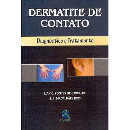Livro - Dermatite de Contato - Diagnóstico e Tratamento - Carvalho