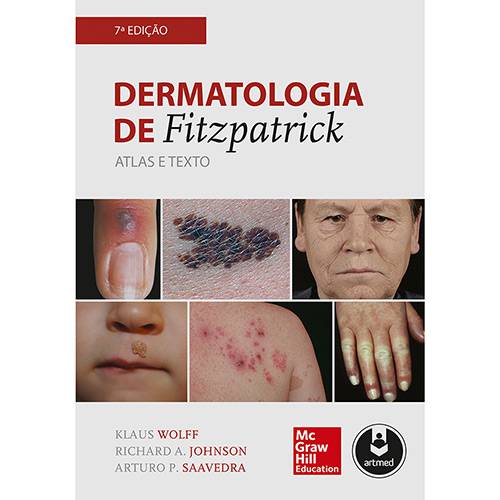 Livro - Dermatologia de Fitzpatrick: Atlas e Texto