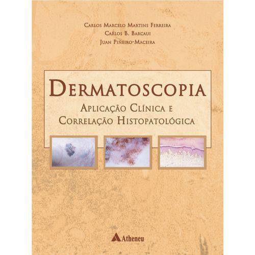 Livro - Dermatoscopia: Aplicação Clínica e Correlação Histopatológica - Barcaui