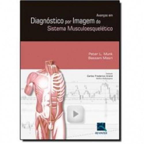 Livro - Diagnóstico por Imagem do Sistema Musculoesquelético - Bohndorf