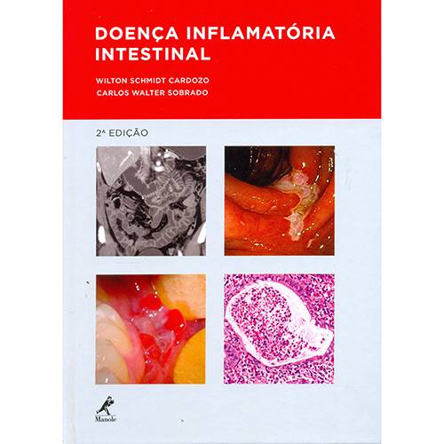 Livro - Doença Inflamatória Intestinal