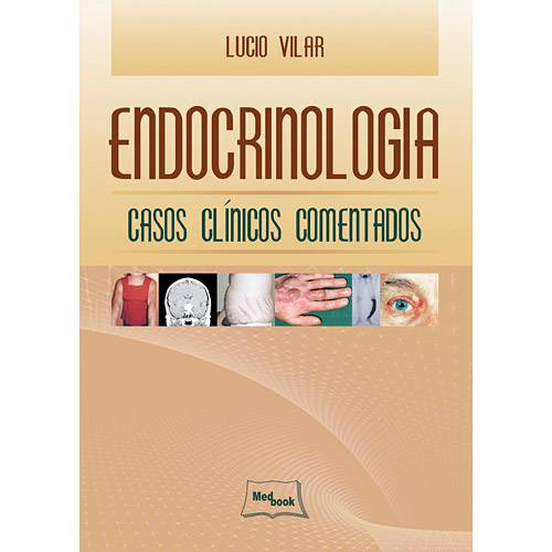 Livro - Endocrinologia - Casos Clínicos Comentados