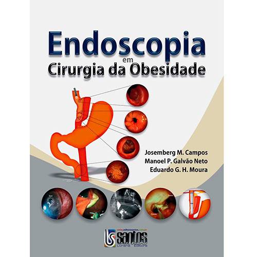 Livro - Endoscopia em Cirurgia da Obesidade