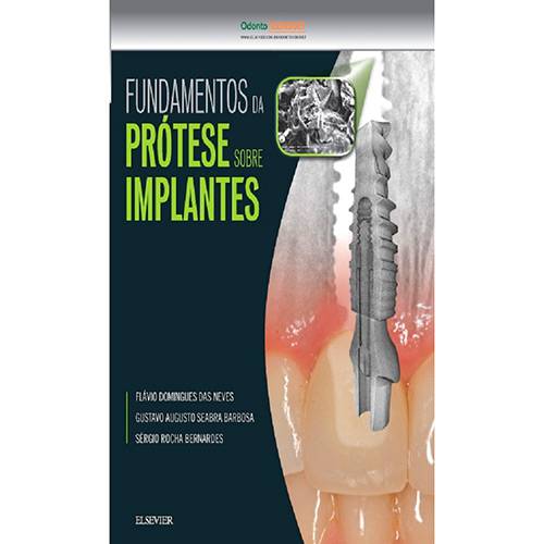 Livro - Fundamentos da Prótese Sobre Implantes