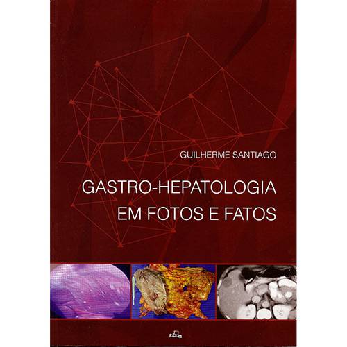 Livro - Gastro-Hepatologia em Fotos e Fatos