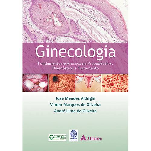 Livro - Ginecologia: Fundamentos e Avanços na Propedêutica e Tratamento
