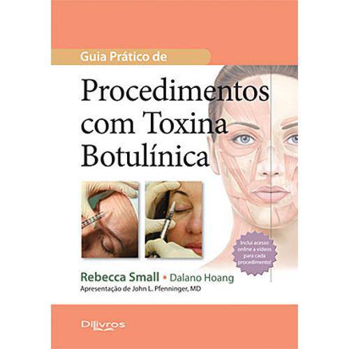 Livro - Guia Prático de Procedimentos com Toxina Botulínica - Small