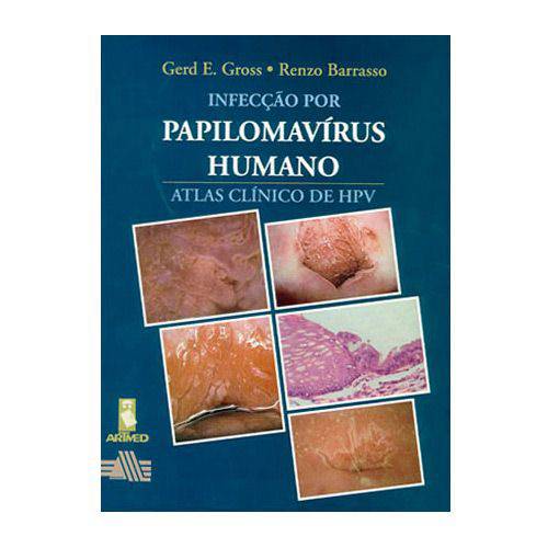 Livro - Infecção por Papilomavírus Humano: Atlas Clínico de HPV
