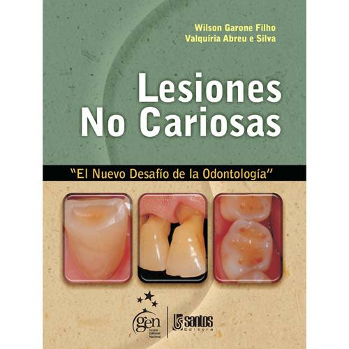 Livro - Lesiones no Cariosas: El Nuevo Desafío de La OdontologÍa