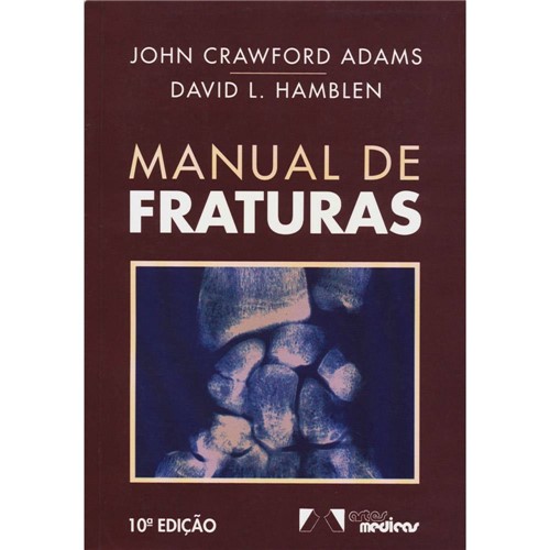 Livro - Manual de Fraturas