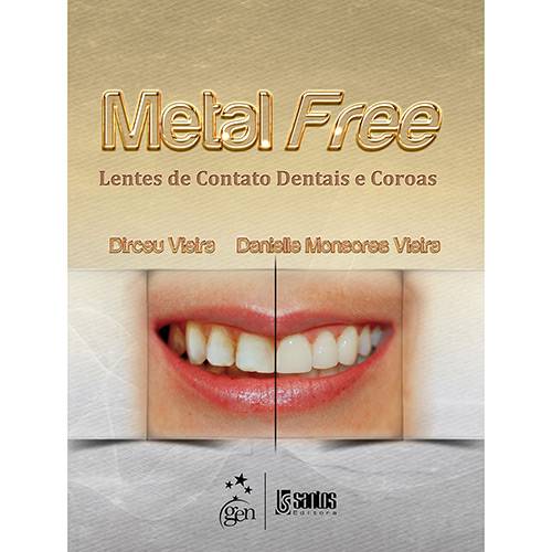Livro - Metal Free: Lentes de Contato Dentais e Coroas