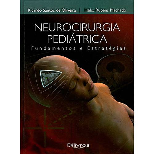 Livro - Neurocirurgia Pediátrica