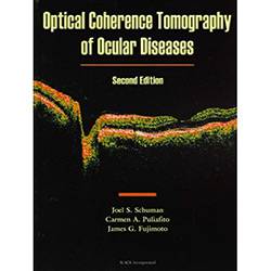 Livro - Optical Coherence Tomography Of Ocular Diseases