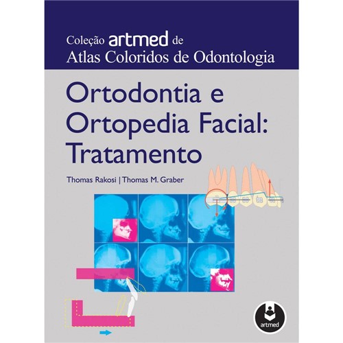 Livro - Ortodontia e Ortopedia Facial: Tratamento