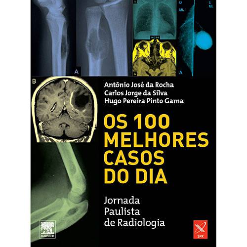 Livro - os 100 Melhores Casos do Dia: Jornada Paulista de Radiologia