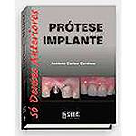 Livro - Prótese Sobre Implante: só Dentes Anteriores
