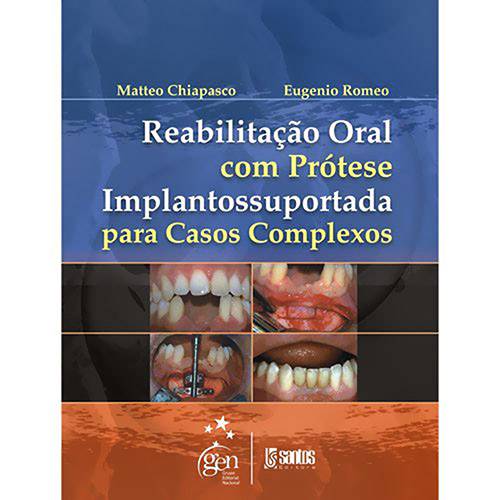 Reabilitação Oral com Protése Implantossuportada para Casos Complexos