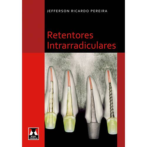 Livro - Retentores Intrarradiculares