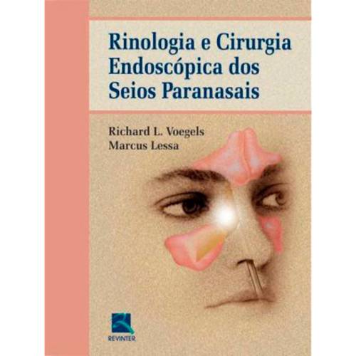 Livro - Rinologia e Cirurgia Endoscópica dos Seios Paranasais