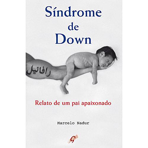 Livro - Síndrome de Down : Relato de um Pai Apaixonado