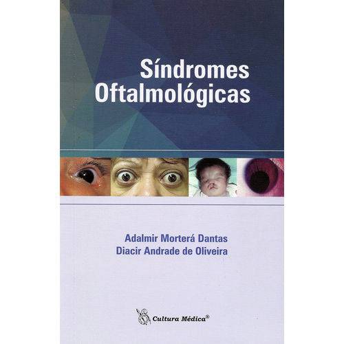 Livro - Síndromes Oftalmológicas - Dantas