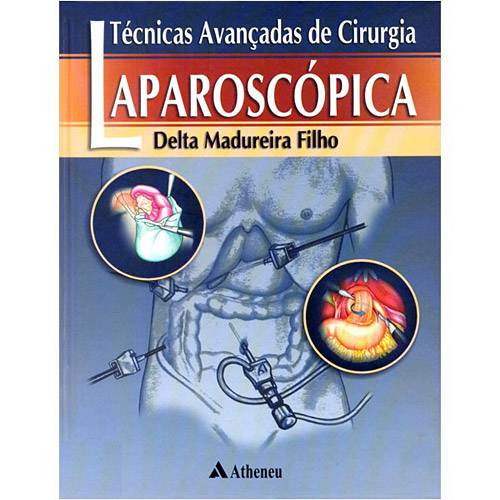 Livro - Tecnicas Avancadas de Cirurgia Laparoscopica Vol 1