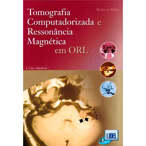 Livro - Tomografia Computadorizada e Ressonância Magnética em ORL